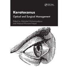 (영문도서) Keratoconus: Optical and Surgical Management Paperback, CRC Press, English, 9781032443232