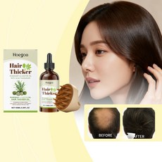 HOEGOA 로즈마리 피마자유 헤어 에센셜 오일 모발 두피케어 헤어브러쉬, 2개, 100ml