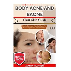 (英文圖書)Body Acne And Bacne Clear-Skin Guide: Simple Tips And Practical Steps For Achiev... 平裝版, Independently Published, 英文