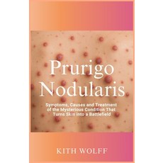 (英文圖書)Prurigo Nodularis: Symptoms Causes and Treatment of the Mysterious Condition T... 平裝版, Independently Published, 英文