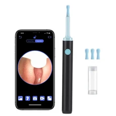Bebird R1 귀 청소기 Minifit 왁스 제거 도구 3M 정밀 카메라 Earpick 검 이경 내시경 개인 건강 관리, 1개