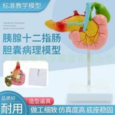 담낭 인체 모형 교육용 시뮬레이션 교구 췌장 십이지장, 담낭병리모델