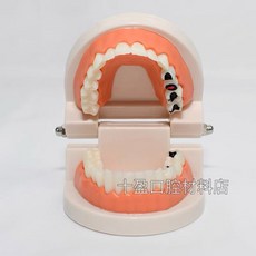치과 치아 모형 교육 모델 브라켓 구강 덴티폼, 일반 치아 모델, 일반 치아 모델