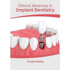 (영문도서) Clinical Advances in Implant Dentistry Hardcover, American Medical Publishers, English, 9781639270514