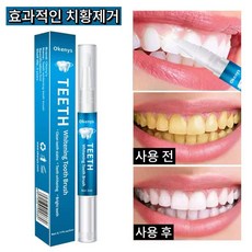 치아미백펜 치아미백 황치/담뱃때/치석/커피때/차때/치반제거 펜 하나로 치아고민 모두 해결, 3개, 5ml