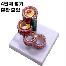 혈관 모형 동맥경화 모델 해부학 인체 신체 구조 교육, B