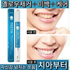 치아미백펜 치아미백 황치/담뱃때/치석/커피때/차때/치반제거 펜 하나로 치아고민 모두 해결, 4개, 5ml