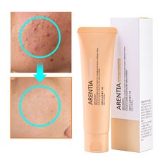 율무크림 율무 피부요철 율무영양크림 피부 오돌토돌 좁쌀 피부 요철 피부결개선 얼굴 눈밑 나비존 모공 비립종, 2개, 50ml