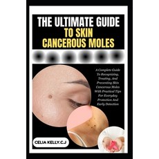 (英文圖書)The Ultimate Guide to Skin Cancerous Moles: A Complete Guide To Recognizing Tre... 平裝版, Independently Published, 英文