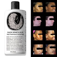 알로에 블랙 비누 얼굴 프리 범프 다크 스팟 모든 성분 리퀴드, 1개