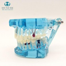 치과 치아모형 충치 구강 진료실 교육용 모형 이빨 임플란트 교육, 3박스