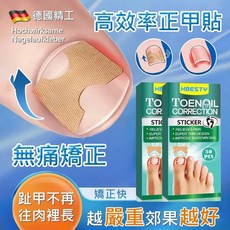 德國進口 甲溝炎矯正神器 凍甲矯正貼片 嵌甲捲甲分離神器, 1個, 正甲貼50貼/盒-1盒單價【數量請下1】, 無味