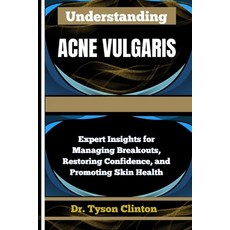 (英文圖書)Understanding Acne Vulgaris: Expert Insights for Managing Breakouts Restoring C... 平裝版, Independently Published, 英文