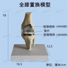 무릎 관절 모델 인체모형 인체 뼈 모형 해부학 교육 교육용 무릎관절, A. 무릎 전치환술