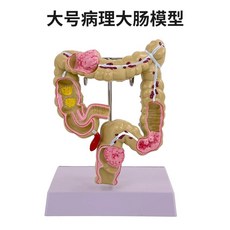 소화계 모형 장기 소화기관 대장 소장 해부 모델 입체 단면, A. 대장 모델