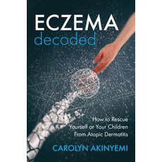 (영문도서) Eczema Decoded: How to Rescue Yourself or Your Children from Atopic Dermatitis Paperback, Chaconia Press, English, 9781999699635
