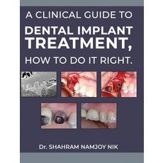 (英文圖書)A clinical guide to dental implant treatment how to do it right. 精裝版, Dr Shahram Namjoy, 英文
