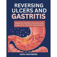 (英文圖書)Reversing Ulcers and Gastritis: Digestive Comfort Practices and Supportive Lifes... 平裝版, Independently Published, 英文