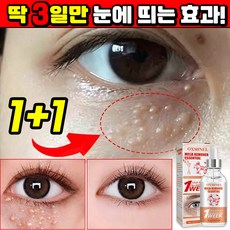 [효과보장] 1/1+1/2+2 눈밑 지방제거 에센스 비립종 제거 앰플 피부요철 각질제거 눈가주름 개선 다크서클 눈밑꺼짐 아이백 아이크림 YONICE, 2개, 30ml