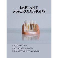 (영문도서)Implant Macrodesigns Paperback, Notion Press, English, 9798898264185