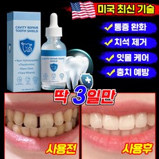 [치약 추천 1위] 하이드록시아파타이트 치아 보호 드롭제 드립제 약국 전용 치아회복액 치약 잇몸 재생 염증 케어 예방 완화, 1개, 60ml