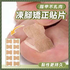 凍甲矯正貼片 崁甲凍甲器 捲甲指溝炎 指甲貼片 正甲貼 指甲縫 清垢棒 指甲墊 甲溝炎 嵌甲指甲 凍甲, 1個