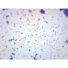 [ 1191113 ] 이이스코스 코커스 도말 그람 양성 염색 - 준비된 현미경 슬라이드 75 x 25mm 생물학 및, Single Slide