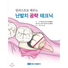 일러스트로 배우는난발치 공략 테크닉, 대한나래출판사, 야마우치 겐스케,고야마 게이스케 저/김철환 역