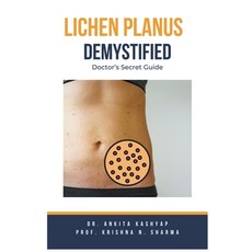 (영문도서) Lichen Planus Demystified Doctors Secret Guide Paperback, Virtued Press, English, 9798223825203