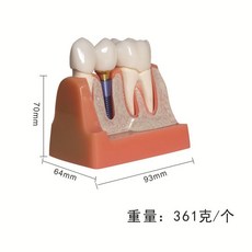 치아 구강교육 4배치 모형 임플란트 분석 크라운시술 분해, 기본선택