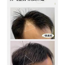 엠자 탈모 및 헤어라인 커버 100% 인모 붙이는 부분가발, 2개, (기본 사이즈)가로 : 약 3.5cm 세로 : 2.5