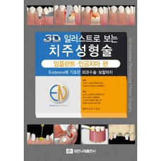 3D 일러스트로 보는 치주성형술:임플란트 인공치아 편, 대한나래출판사, 오카다 소헤이타 , 오다 노리미 , 소노야마 와타루 , 야마바 토오루