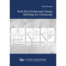 (영문도서)Real-time Endoscopic Image Stitching for Cystoscopy Paperback, Cuvillier, English, 9783736996465