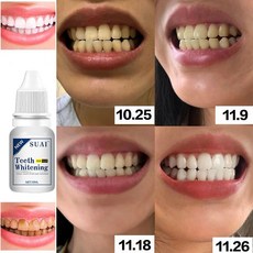 2+1/3+2 치아미백 세럼 셀프 화이트닝 플라크 구강 위생 클렌징 얼룩 제거, 3개, 10ml