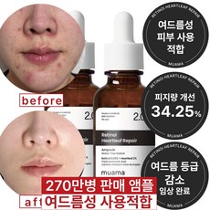 여드름성 피부 사용 적합 사춘기 트러블 진정 개선 흉터 모공감소 피지연화 5종 임상완료 [누적 270만병] 고함량 나이아신아마이드 레티놀 어성초 히알루론산 뮤아마 앰플 세럼, 2개, 30ml