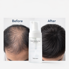 스칼프 부스팅 두피 탈모 앰플 부스팅 앰플 카페인 헤어 인핸싱 폼 두피 모발 헤어 토닉 앰플 영양제 탈모 헤어토닉 두피 앰플 여성 탈모 앰플로게인폼 정수리탈모 헤어라인 앰플, 4개, 110ml