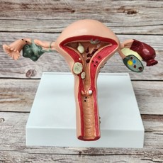 여성 자궁 병변 해부학 인체 모형 스탠드 안내서, 1세트