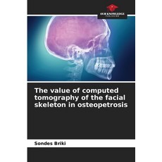 (영문도서)The value of computed tomography of the facial skeleton in osteopetrosis Paperback, Our Knowledge Publishing, English, 9786209099830