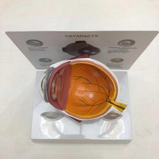 안구 모형 백내장 교육용 병원 의료 병변 해부