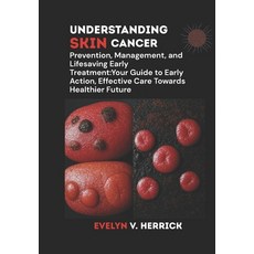 (영문도서)Understanding Skin Cancer: Prevention Management and Lifesaving Early Treatmen... Paperback, Independently Published, English, 9798287021269