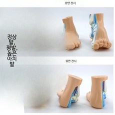 인간 발 모형 해부 해부학 교육용 평발 정상 G_발 해부 세트 - 손글씨 버전, 1개