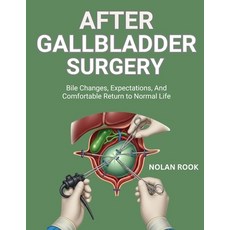(영문도서)After Gallbladder Surgery: Bile changes expectations and comfortable return to... Paperback, Independently Published, English, 9798274956581