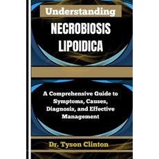 (英文圖書)Understanding Necrobiosis Lipoidica: A Comprehensive Guide to Symptoms Causes ... 平裝版, Independently Published, 英文
