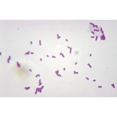 영구프레파라트/대장균