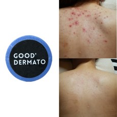 굿더마토 Mint for 데코르테 바디바 (등가슴 몸트러블 싹! 등드름 좁쌀 햇빛알러지 딥클렌징 천연수제비누 워시), 115g, 1개, 1개입