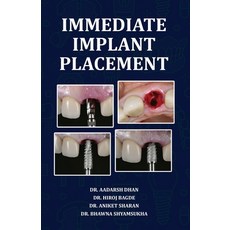 (영문도서) Immediate Implant Placement Paperback, Taneesha Publishers, English, 9788197792724