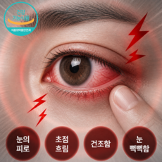 눈 건조 영양제 눈건강 영양제 눈 피로 영양제 눈 영양제 루테인 지아잔틴, 1개, 30정