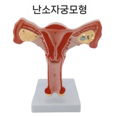 여성 자궁 모형 난소 생식기 골반 회음 근육 교육 상담, 1. 양측 난소 자궁, 1개