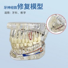 치아모형 치과 탈착식 임플란트 투명 개폐형 교육용 전시, 치아 신경 모델