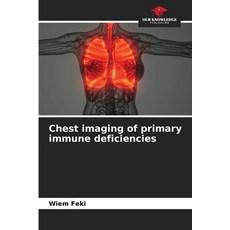 (영문도서)Chest imaging of primary immune deficiencies Paperback, Our Knowledge Publishing, English, 9786209272233